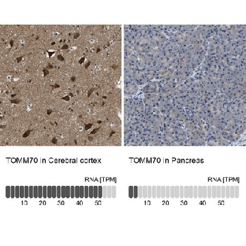 Anti-TOMM70 antibody produced in rabbit，100UL，HPA014589-100UL，Sigma