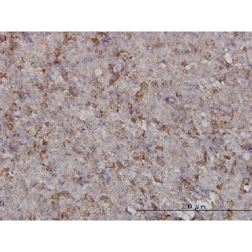 Monoclonal Anti-KIF2C antibody produced in mouse，100UG，WH0011004M1-100UG，Sigma