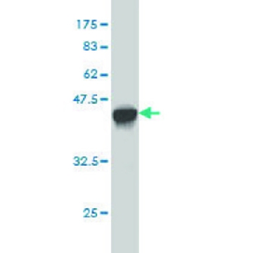 Monoclonal Anti-GAA antibody produced in mouse，100UG，WH0002548M1-100UG，Sigma
