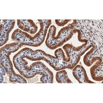 Anti-STAT6 Antibody, clone 1C13 ZooMAb® Rabbit Monoclonal，4X25UL，ZRB1949-4X25UL，Sigma