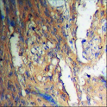 Anti-phospho-Akt (pThr³⁰⁸) antibody produced in rabbit，100UG，SAB4504332-100UG，Sigma