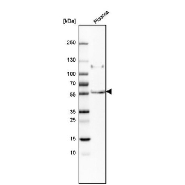 抗-PI16 兔抗，100UL，HPA043763-100UL，Sigma