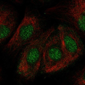 Anti-ZNF319 antibody produced in rabbit，100UL，HPA052584-100UL，Sigma