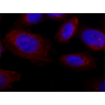 Anti-Collagen, Type X antibody, Mouse monoclonal，25UL，SAB4200800-25UL，Sigma