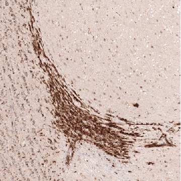 Monoclonal Anti-SOX4 antibody produced in mouse，100UL，AMAB91380-100UL，Sigma