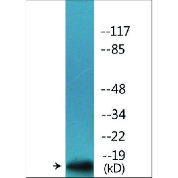 抗  磷酸-p16-INK4a (pSer  152 ) 兔抗，100UG，SAB4504720-100UG，Sigma