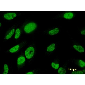 ANTI-TBX18 antibody produced in mouse，100UG，SAB1412362-100UG，Sigma