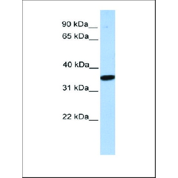 Anti-MOGAT1 antibody produced in rabbit，100UL，AV50240-100UL，Sigma