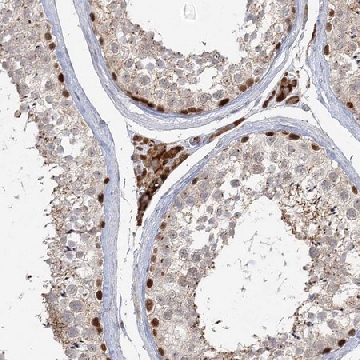Anti-KBTBD4 antibody produced in rabbit，100UL，HPA037792-100UL，Sigma