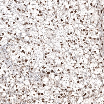 Anti-TFE3 antibody produced in mouse，100UL，AMAB91799-100UL，Sigma