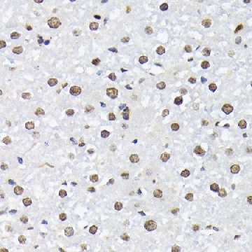 Anti-Phospho-FoxO1-T24/FoxO3a-T32/FoxO4-T28 antibody produced in rabbit，100UL，SAB5700524-100UL，Sigma