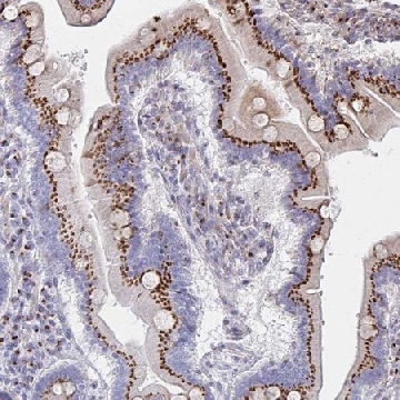 Anti-MAN1A1 antibody produced in rabbit，100UL，HPA053198-100UL，Sigma