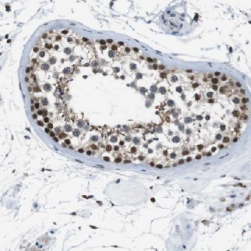 Anti-USP7 antibody produced in rabbit，100UL，HPA015641-100UL，Sigma