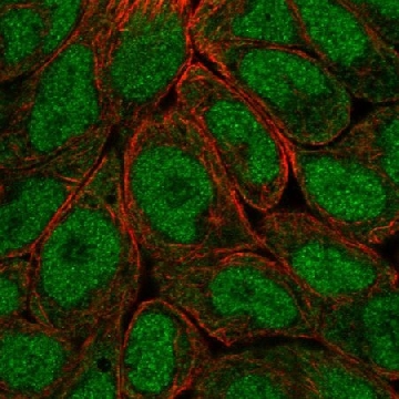 Anti-OASL antibody produced in rabbit，100UL，HPA001474-100UL，Sigma