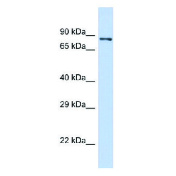 Anti-PIEZO2 (N-terminal) antibody produced in rabbit，100UL，SAB2108846-100UL，Sigma