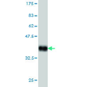 Monoclonal Anti-SHOX2 antibody produced in mouse，100UG，WH0006474M1-100UG，Sigma