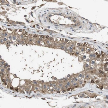 Anti-FZD10 antibody produced in rabbit，100UL，HPA014485-100UL，Sigma