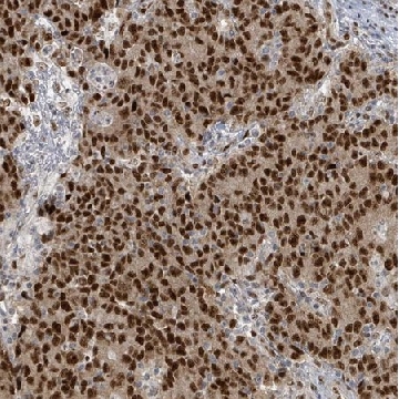 Anti-KLF3 antibody produced in rabbit，100UL，HPA049512-100UL，Sigma