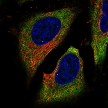 Anti-FAM134B antibody produced in rabbit，100UL，HPA012077-100UL，Sigma