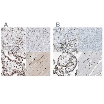 Anti-MEF2D antibody produced in rabbit，100UL，HPA004807-100UL，Sigma