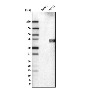 Monoclonal Anti-SOX11 antibody produced in mouse，100UL，AMAB90501-100UL，Sigma