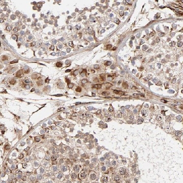 Anti-DNAAF2 antibody produced in rabbit，100UL，HPA004113-100UL，Sigma