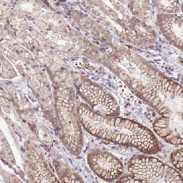 Anti-TM2D1 antibody produced in rabbit，100UL，HPA046058-100UL，Sigma
