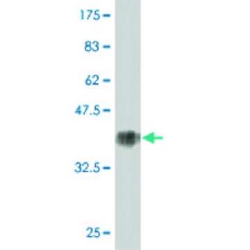 Monoclonal Anti-KRT1 antibody produced in mouse，100UG，WH0003848M1-100UG，Sigma