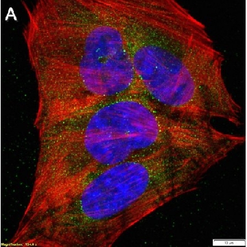 Anti-m6A Antibody, clone 17-3-4-1 ZooMAb® Mouse Monoclonal，25UL，ZMS1124-25UL，Sigma