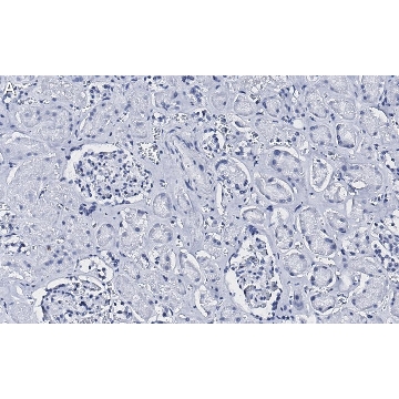 Anti-CD34 Antibody, clone 5C15 , ZooMAb® Rabbit Monoclonal，4X25UL，ZRB1232-4X25UL，Sigma