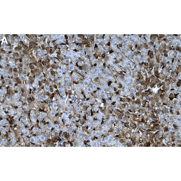 Anti-C1QA Antibody, clone 1M12 ZooMAb® Rabbit Monoclonal，4X25UL，ZRB2039-4X25UL，Sigma