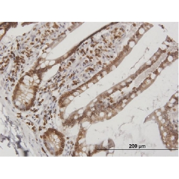 Anti-LBR antibody produced in mouse，50UG，SAB1400151-50UG，Sigma