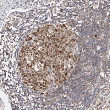 Anti-CDCA7L antibody produced in rabbit，100UL，HPA027169-100UL，Sigma