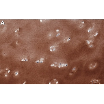 Anti-Collagen Type II Antibody, clone 1K11 ZooMAb® Rabbit Monoclonal，4X25UL，ZRB1201-4X25UL，Sigma