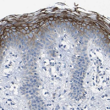 Anti-DSC1 antibody produced in rabbit，100UL，HPA012891-100UL，Sigma