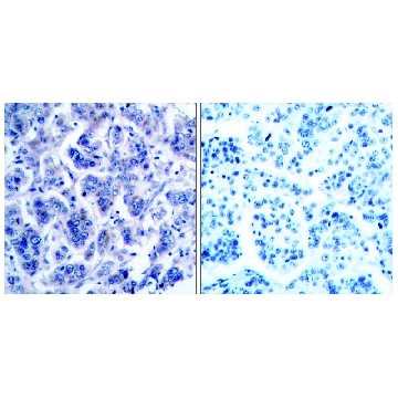 Anti-TYK2 antibody produced in rabbit，100UG，SAB4503050-100UG，Sigma