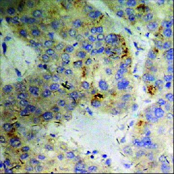 Anti-phospho-PKD2 (pSer⁸⁷⁶) antibody produced in rabbit，100UG，SAB4504104-100UG，Sigma