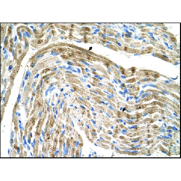 Anti-FADS1 antibody produced in rabbit，100UL，SAB2108009-100UL，Sigma