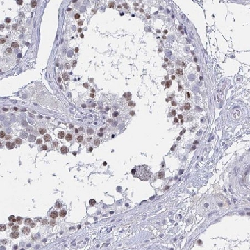 Anti-KDM4D antibody produced in rabbit，100UL，HPA055854-100UL，Sigma