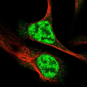 Anti-RAD54L antibody produced in rabbit，100UL，HPA028954-100UL，Sigma