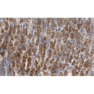 Anti-PNPT1 Antibody, clone 2D23 ZooMAb® Rabbit Monoclonal，25UL，ZRB1066-25UL，Sigma
