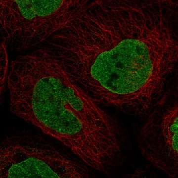 Anti-PAPD7 antibody produced in rabbit，100UL，HPA045487-100UL，Sigma