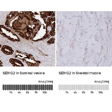 Anti-SEMG2 antibody produced in rabbit，100UL，HPA042835-100UL，Sigma