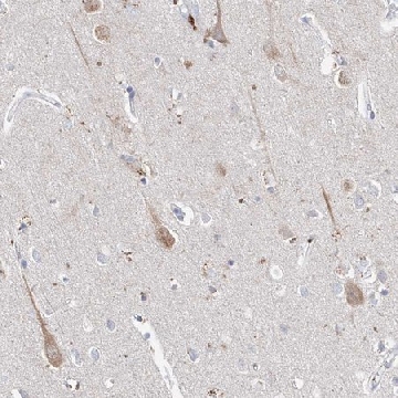 Anti-ASNS antibody produced in rabbit，100UL，HPA029318-100UL，Sigma