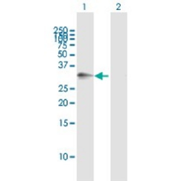Anti-ATP1B3 antibody produced in mouse，50UG，SAB1405498-50UG，Sigma