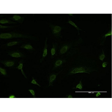 Monoclonal Anti-BCL9 antibody produced in mouse，100UG，SAB1403599-100UG，Sigma