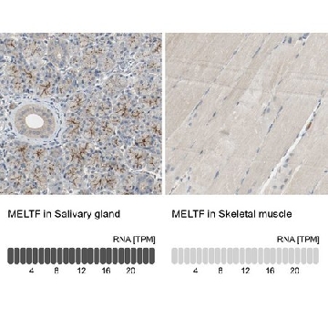 Anti-MELTF antibody produced in rabbit，100UL，HPA004880-100UL，Sigma