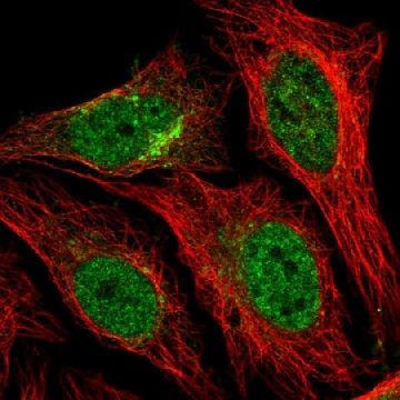 Anti-STX12 antibody produced in rabbit，100UL，HPA055300-100UL，Sigma
