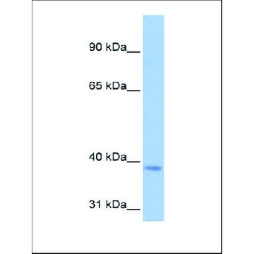 Anti-NSUN3 antibody produced in rabbit，100UL，AV48884-100UL，Sigma