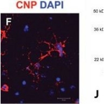 抗-CNPase单克隆抗体 小鼠抗，100UL，C5922-100UL，Sigma